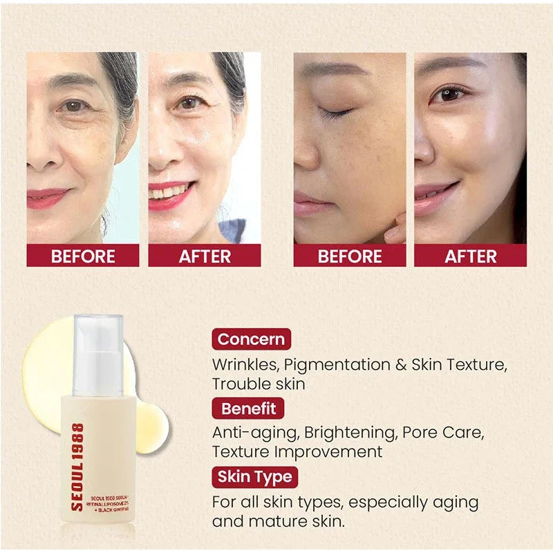 Korean 1988 Retinol Face Serum – Black Ginseng, Niacinamide, Vitamin C, Anti-Aging & Moisturizing
